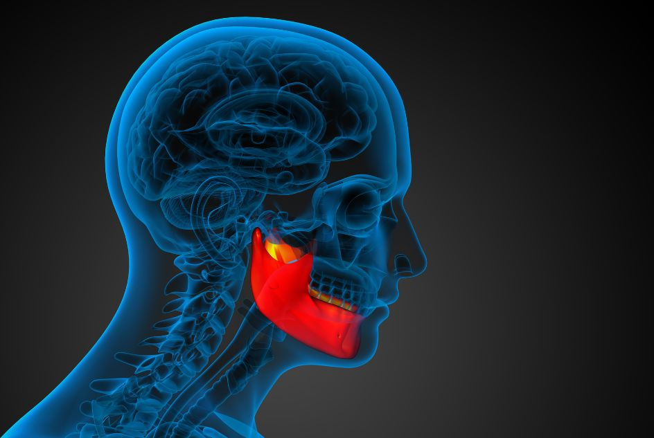 Augmentacja kości szczęki przed zabiegiem implantacji – na czym polega i dlaczego jest tak istotna?